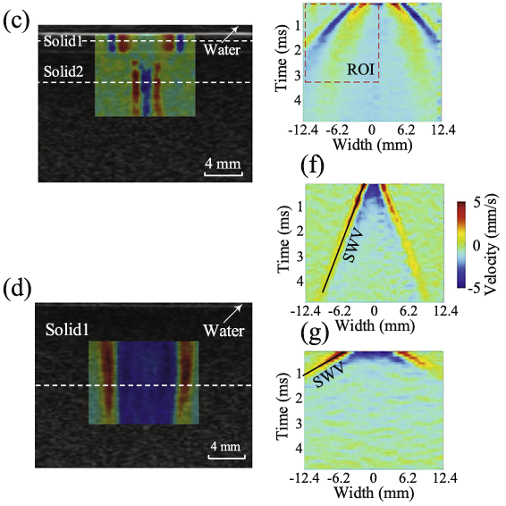 Guided wave elastography of layered soft tissues