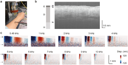 In vivo stiffness measurement of epidermis, dermis, and hypodermis using broadband Rayleigh-wave optical coherence elastography