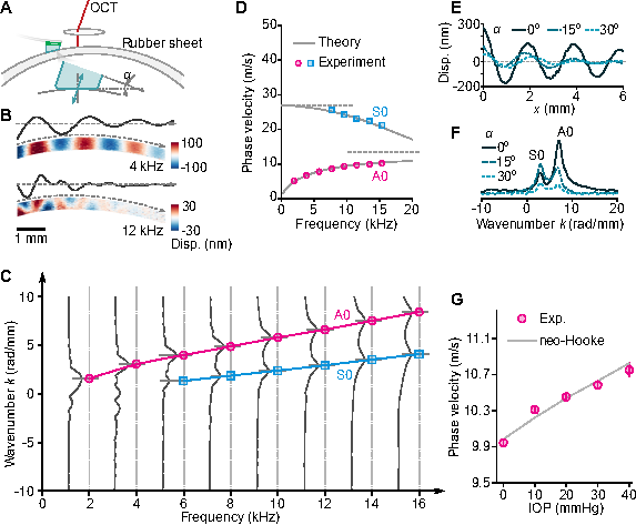 Simultaneous tensile and shear measurement of the human cornea in vivo using S0- and A0-wave optical coherence elastography