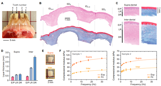 High-Frequency Optical Coherence Elastography for Gingival Tissue Characterization: Variability in Stiffness and Response to Physiological Conditions