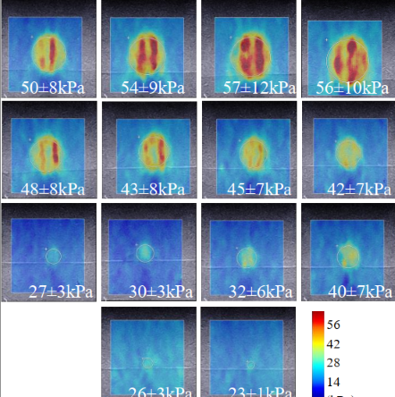 Size effect in shear wave elastography of small solid tumors – A phantom study