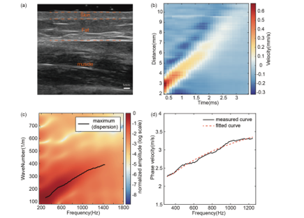 Guided wave elastography of human skins with a layered model incorporating the effect of muscle state