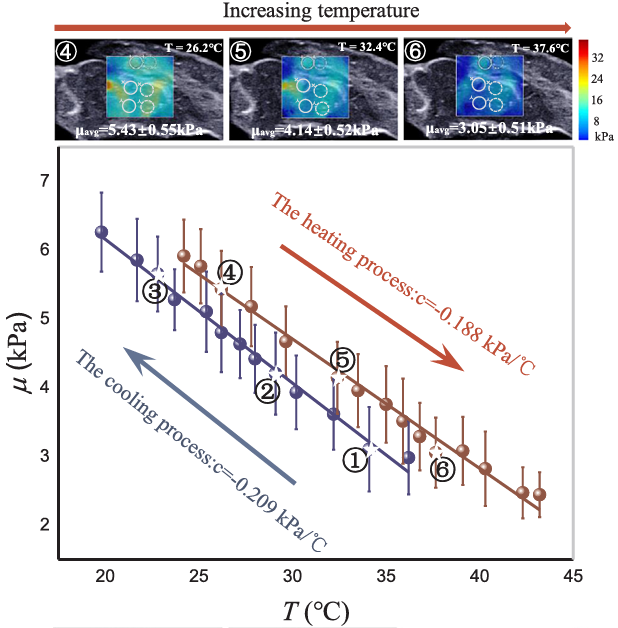 In vivo and ex vivo elastic properties of brain tissues measured with ultrasound elastography