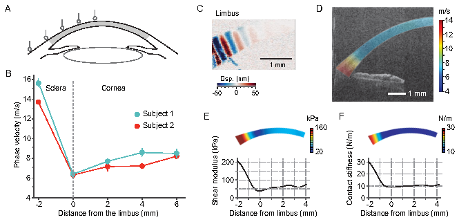 In Vivo Optical Coherence Elastography Unveils Spatial Variation of Human Corneal Stiffness