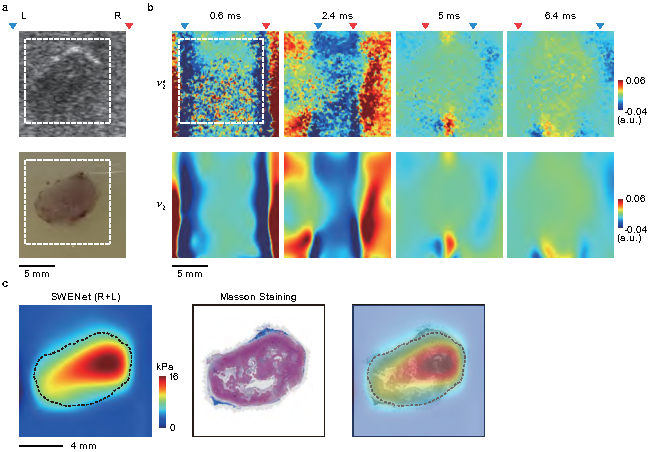 SWENet: A Physics-Informed Deep Neural Network (PINN) for Shear Wave Elastography